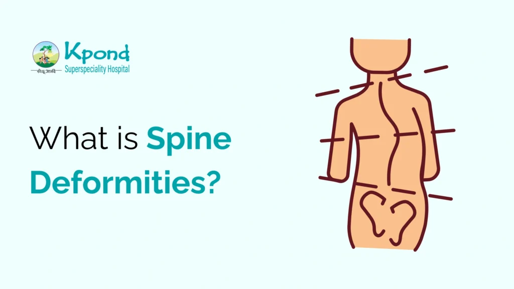 What is Spine Deformities?